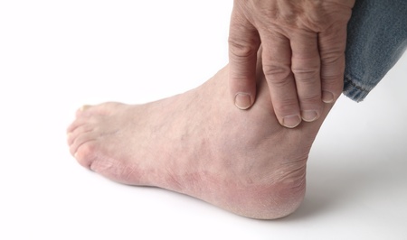 How to Deal With Achilles Tendon Pain